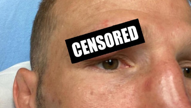 Ти Джей Диллашоу получил рассечение, бой с Сэндхагеном отменен