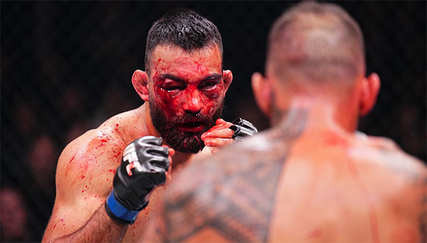 Результаты UFC в Париже: сломанные ключицы и мечты