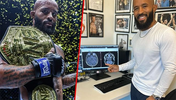 Что показали исследования мозга Могучего Мышонка?