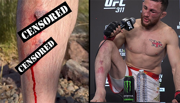 Не для слабонервных: травма Мераба перед боем